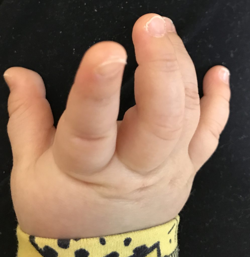 育児 一番簡単な赤ちゃんの爪の切り方
